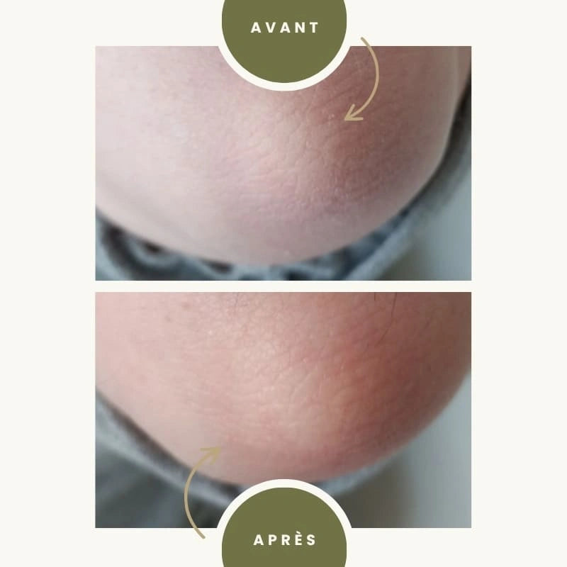 Lait corps hydratant à l'Aloé Vera Bio - Avant après - NaturAloé