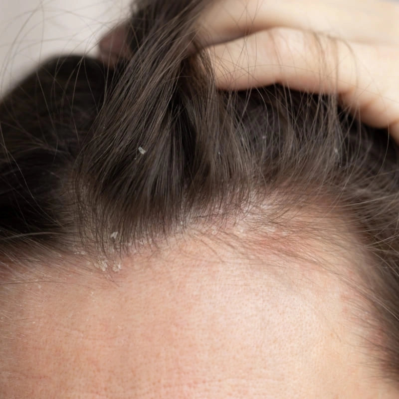 Routine cosmétiques corps et cheveux problèmes capillaires - NaturAloé