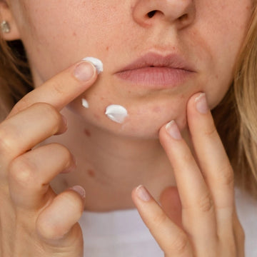 Routine Anti-Imperfections – Visage
